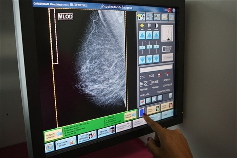 Casi 7.000 extremeñas se harán mamografías en septiembre dentro del Programa de Detección Precoz del Cáncer de Mama