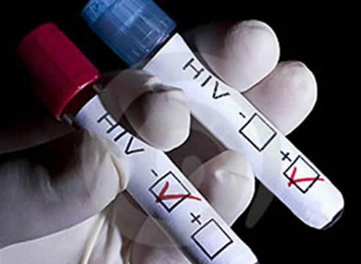 Hoy se celebra el Día mundial de la prueba del VIH