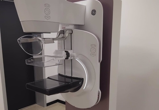 El Hospital Siberia Serena cuenta con un nuevo mamógrafo digital, en el que se han invertido 190.000 euros