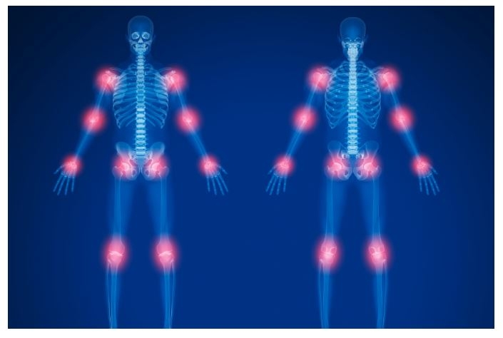 Diputación de Cáceres y FEXAF elaboran una guía sobre el dolor crónico para informar, orientar y apoyar a las personas afectadas