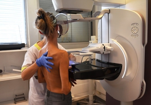 Casi 9.000 extremeñas se realizarán mamografías en enero dentro del Programa de Detección Precoz del Cáncer de Mama