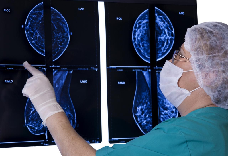 Más de 9.000 extremeñas se realizarán mamografías en junio dentro del Programa de Detección Precoz del Cáncer de Mama